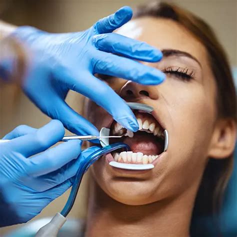 Dentist Barbican .